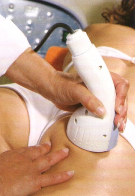 Radiofrecuencia Rmodel